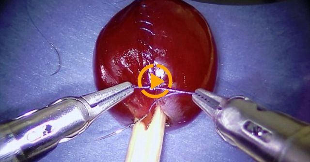Da Vinci Robot Stitches A Grape Back Together