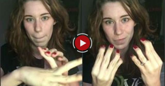 My Hand Hypermobility 