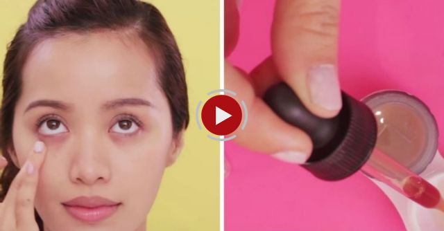 How To Get Rid Of Dark Circles