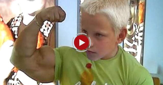 10 Strangest Medical Conditions