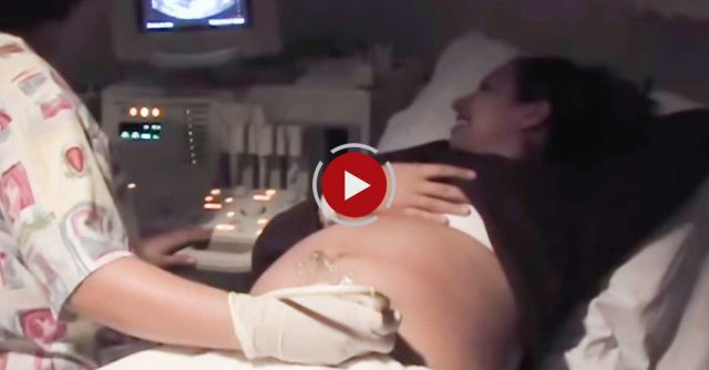 Mom to be gets ultra sound surprise!  best surprise ever