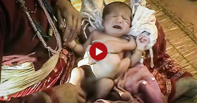 My Shocking Story - The Parasitic Twin