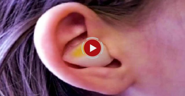 Ear Ache? Grab An Onion!