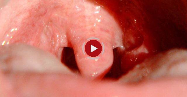 Slow Mo Gargling Uvula - The Slow Mo Guys