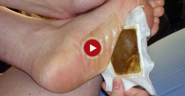 Kinoki Detox Foot Pads