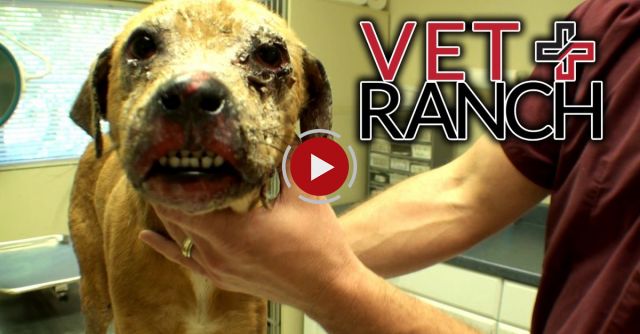 Terrible Burn On His Face