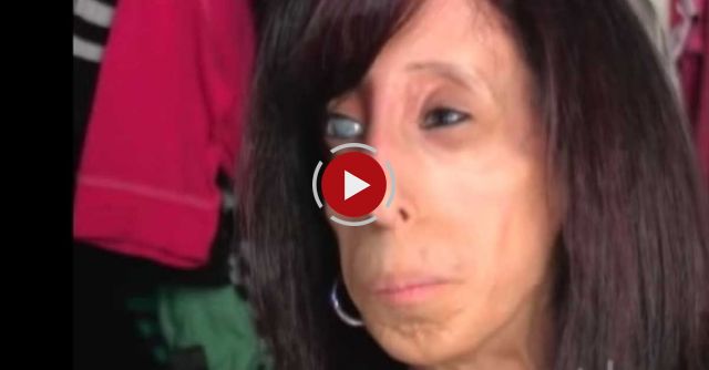 Lizzie Velasquez: Girl Must Eat Every 15 Minutes - Inspirational Story