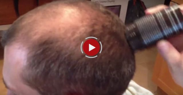 A Woman Pours This Thing On His Head: The Effect Is Incredible