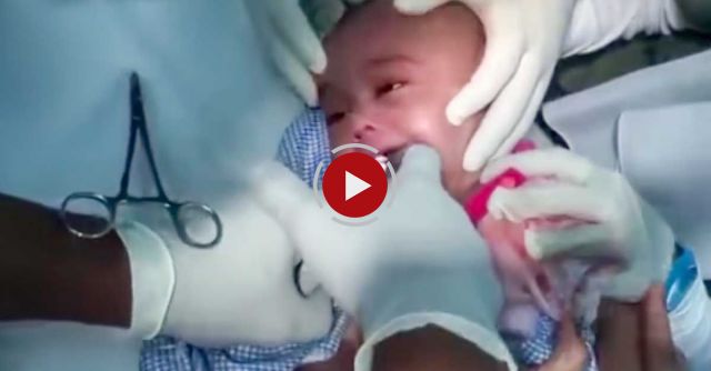 Doctors Knew Exactly What To Do When This Child Swallowed A Watch 