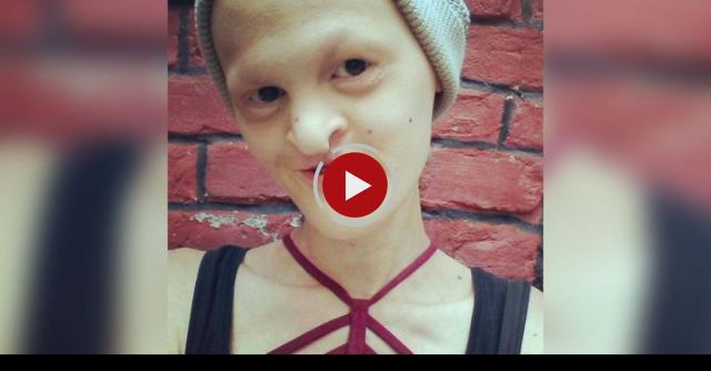 Genetic Disorder Sufferer Defies Critics To Become International Model