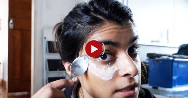 Get Rid Of Dark Circles And Bags FAST! | 5min Undereye Treatment With Baking Soda