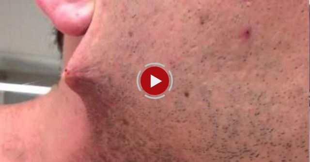 Man Shaves His Beard Off But He Got Terrified When He Found Out...