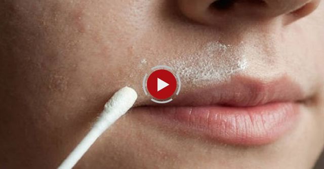 Removing Facial Hair - Natural Ayurvedic Home Remedies