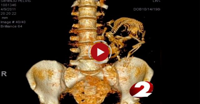 Woman's Story To End Texting While Driving