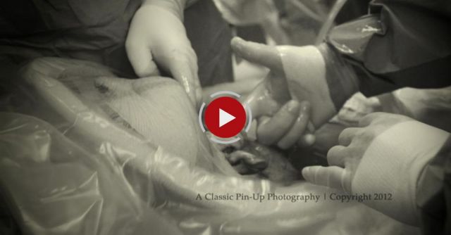 Baby In Womb Grabs Doctor's Hand