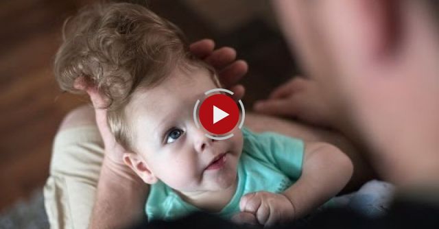 Saving Bentley’s Brain: Daring Surgery Aims To Fix A Gaping Hole In Baby’s Skull