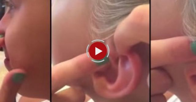 This Girl Squeezes A 6-year-old Ear Zit And A Helluva A Lot Of Pus Comes Out