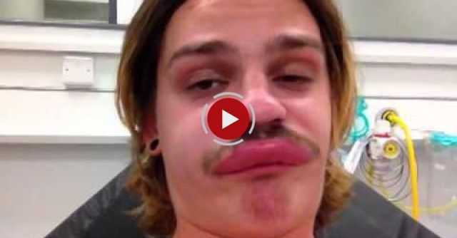 This Guy Got Bitten By A Bug