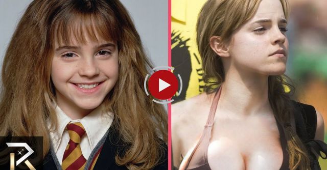 10 Awkward Child Celebrities Who Became Hot
