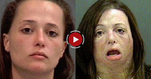 Top 10 Shocking Before And After Drug Use Photos